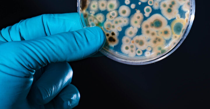 Bacteria to help recycle EV batteries?